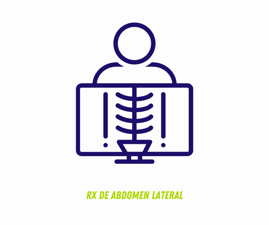 RX DE ABDOMEN LATERAL