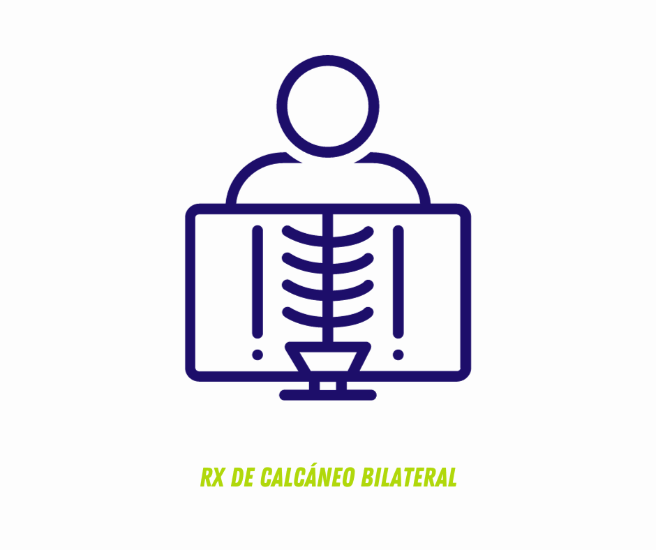 RX DE CALCÁNEO BILATERAL