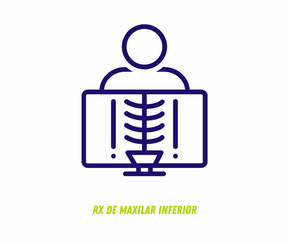 RX DE MAXILAR INFERIOR