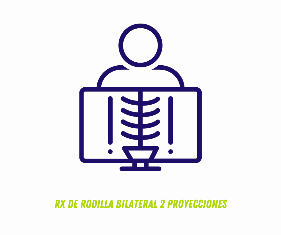 RX DE RODILLA BILATERAL 2 PROYECCIONES