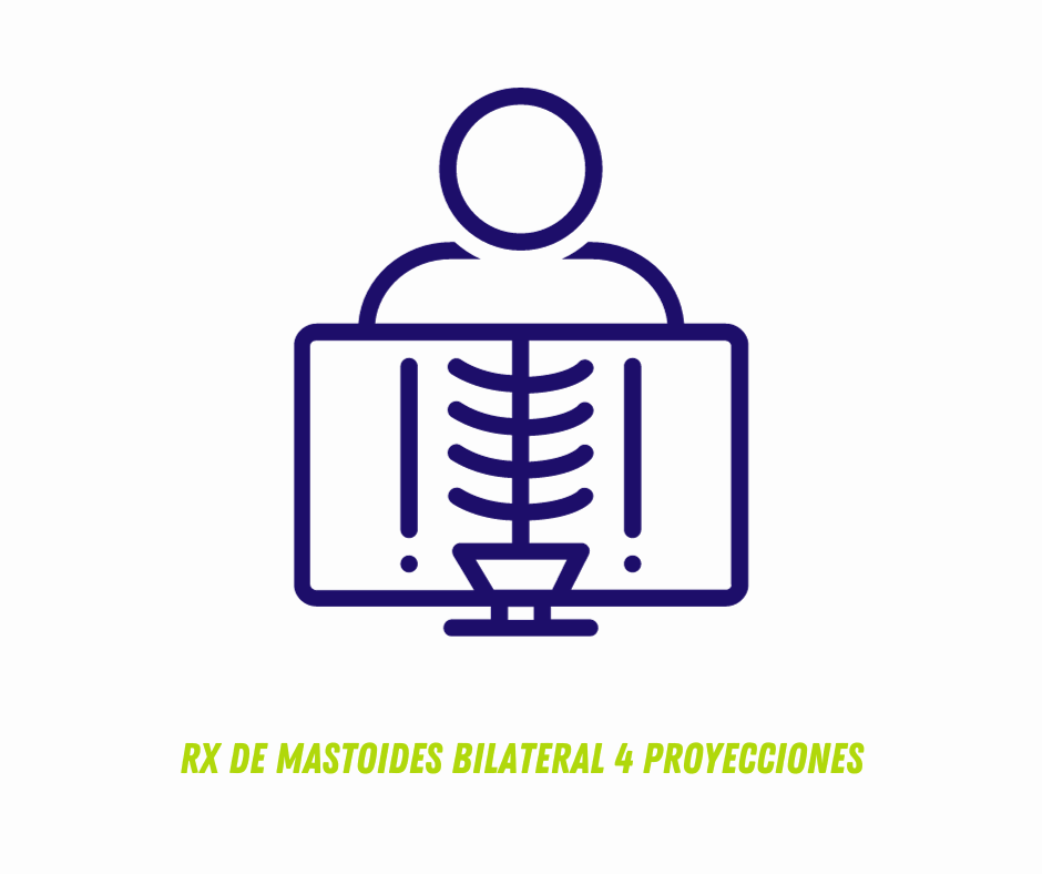 
RX DE MASTOIDES BILATERAL 4 PROYECCIONES