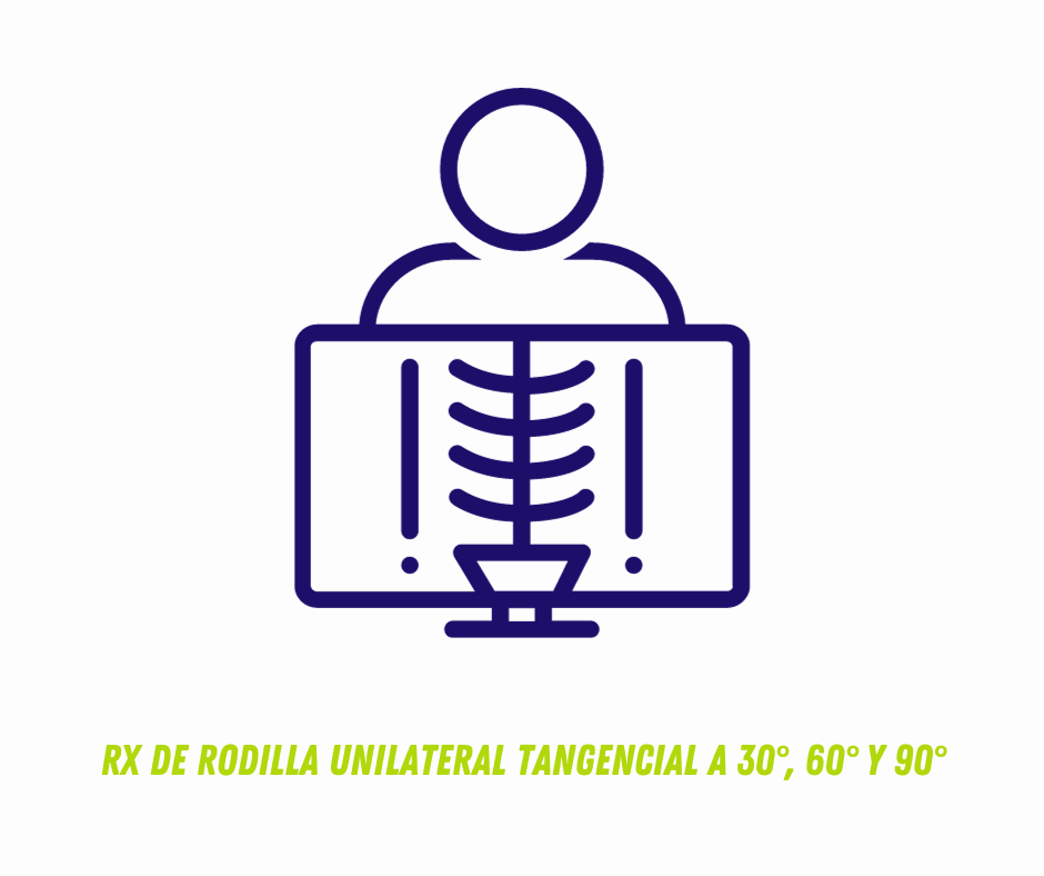 RX DE RODILLA UNILATERAL TANGENCIAL A 30°, 60° Y 90°